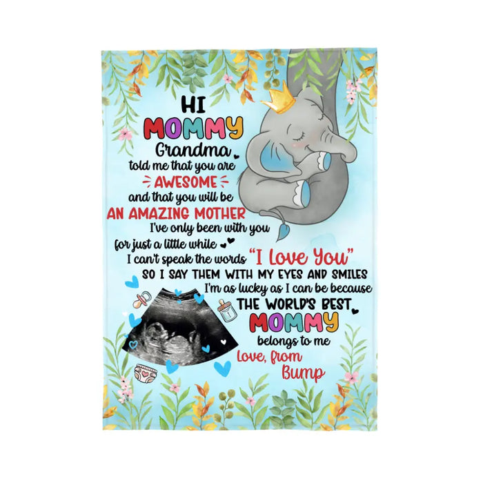 Hi Mommy You Are Awesome And Amazing - Custom Blanket For Mom To Be, For Her, Mother's Day